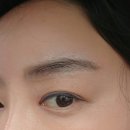 미마루 | 전주 효자동 눈썹 문신 잔흔 제거 대만족 후기 미마루나