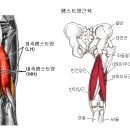 햄스트링(허벅지 후면 근육을 슬굴곡근) 통증의 원인과 치료방법- 이미지