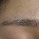 [공지] 톤즈의원 강서 (발산점) 피부과 내돈내산 솔직 후기(+완전비추)_결혼준비피부과