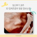 임신후기 28주 3D 입체초음파 얼굴 잘보는법