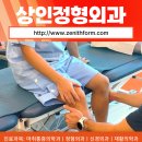 골든정형외과의원 | 상인정형외과 수술후 재활은 선택이 아닌 필수!