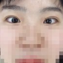 블리아이