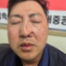 합법 파업 중인 조합원을 폭행하는 현대중공업 경비대 (폭행 사진 주의) 이미지