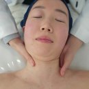 춘천 슈퍼젝션 리쥬란대신 만족후기 - 더차율에서 홍조피부고민 해결 하고 수분충전