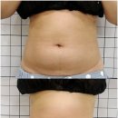 태크니끄 해운대 셀핏 프리미엄 이미지