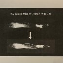 바른손연세재활의학과의원 | 물리치료 보수교육 -림프 재활치료 | 양재역 비수술 체외충격파 통증치료 바른손연세재활의학과