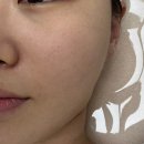 디톡스 | 대구피부관리 제이에르 스킨디톡스후기 : 피부가 숨쉬는 느낌,처음이야 !!