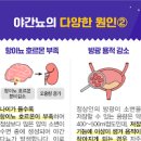 자다가소변 새벽에 잦은 소변 야간 야뇨증 왜 그럴까 이미지