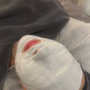 부건프라자 | 부천 상동 여드름관리 솔에스테틱 꼼꼼한 압출 후기