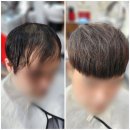 탈모 증모술 자연스러운 후기 사진 및 유지 방법 (부산 히든헤어)