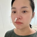 협진약품 | 임신 9개월 33주 32주 임산부 코피증상 폐렴 분당차병원 소화기내과 협진요청한 후기