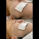 면목천로 | 상봉피부관리 맛집 "세렌느에스테틱" 방문 후기!