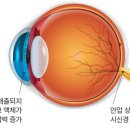 아이데코 이미지