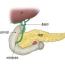 바터 팽대부 암(AOV cancer)| 이미지