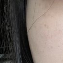 강동오아로피부과의원 이미지