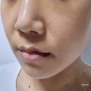 (주)에이티면역 이미지