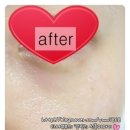 비티엑스 이미지
