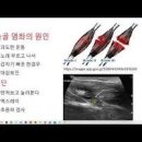 갈비뼈 통증 왼쪽 오른쪽 위 아래 안쪽 밑 숨쉴때 콕콕 찌릿 있을 수 있는 이유 정리함 이미지