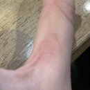 고홍집 | 몸이 또 십창남