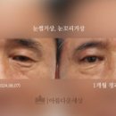 예쁜세상성형외과의원 네이버블로그