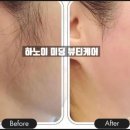 두피&뷰티케어
