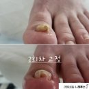 려원네일& 레푸스 네이버블로그