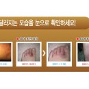 [가려움증 없애주는 미네랄 한방 클렌징 워시] - 20％ 할인 공동구매(종료) 이미지