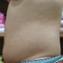 BS블레슈