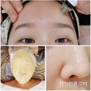 세종 피부관리 나성동 블랙헤드 여드름압출 아르드뽀 후기