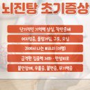 뇌진탕 초기증상 응급처치 후유증 치료 이미지