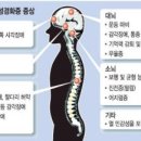 경화 이미지