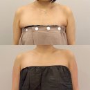 하단하체관리 잘하는 곳, 부산소노온 전문 케어샵 하단빛나스킨룸