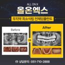 온(ON)치과기공소 이미지
