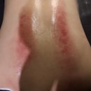 원빌딩 | 반포동 경락관리 <사운드바디사운드스킨> 후기, 아나운서들이 찾는 순금 골드링 관리