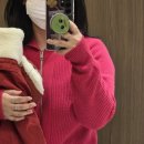 민위멍 | 수원 지방분해주사 2회차 팔뚝: 1회차보다 만족스러운 눈바디 변화 (통증/멍/붓기)