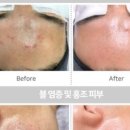 퀸에스테틱 - 성북구 보국문로11길 21-20 | 퀸에스테틱