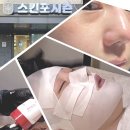 하이얀피부샵 | 동대구 피부관리 추천 &#39;스킨포시즌&#39; - 일대일 맞춤케어 피부도로공사(세멘) 후기