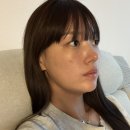 라움성형외과의원 | 압구정 라움성형외과 흑자치료 6개월차 리얼후기 재발 여부까지