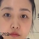 미모아드 이미지