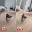 메디셀린 | 노원 무쌍펌 전문점에서 알려드리는 셀프 속눈썹 펌 하면 안되는 이유, 복구펌 후기