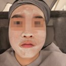 정안사우나 | 천안 불당동 천안 여드름한의원 치료로 깨끗한 피부 만들기 4개월 간의 솔직후기