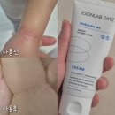 이손 | 아기 겨울철 동전습진 크림 추천｜이손랩 데이즈 스피룰365 후기