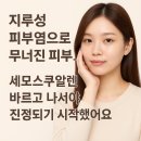 세모스쿠알렌 | 지루성 피부염엔 어떻게 발라야 하나요? 세모스쿠알렌 바르는 순서, 피부과 원리로 알려드릴게요
