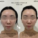 무니크뷰티(Moonique) | 부천에어바디 무니크 자연스럽게 이뻐진 만족후기