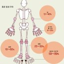 개다래충영(목천료) 의 (통풍)효능 이미지