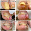 타임네일 페디베네 이미지