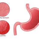 이유한의원 이미지