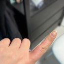 설상훈심사랑내과의원 | 260216 일상 - 잊고 있던 갑각류 알러지 어게인과 1주년 파티