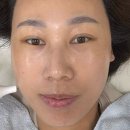 보니따피부관리 이미지