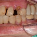 수원탑플란트치과의원 이미지